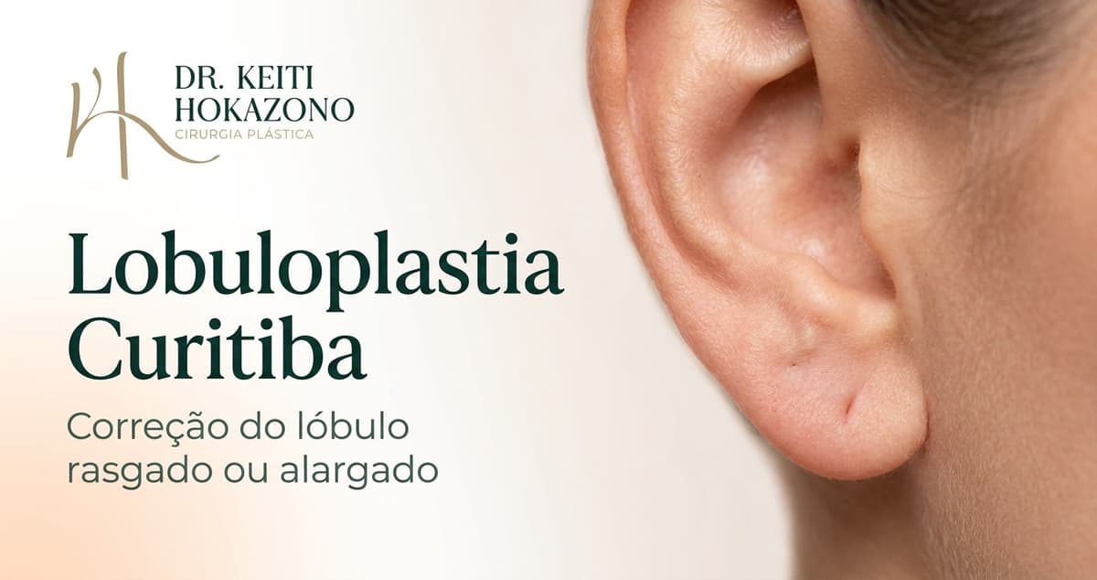 Imagem relacionada ao artigo Lobuloplastia Curitiba