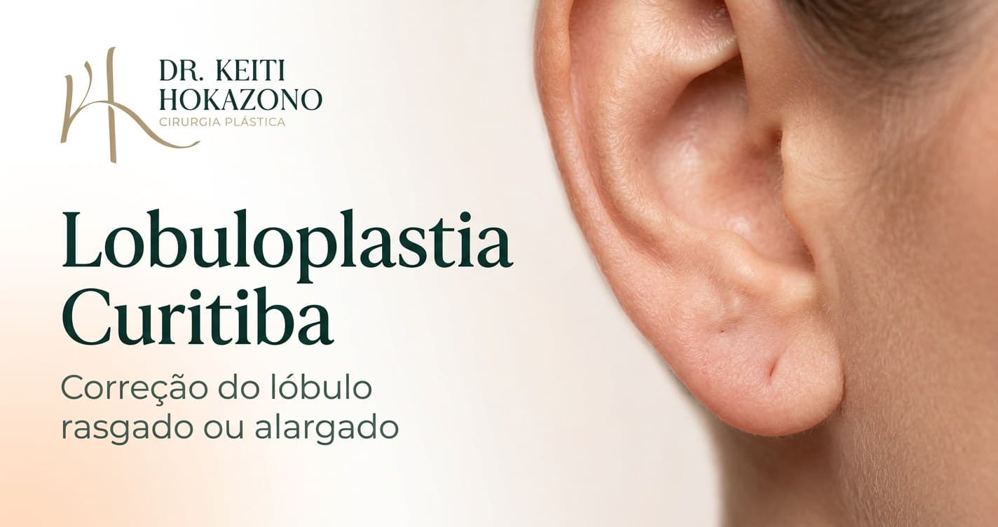 Lobuloplastia Curitiba: imagem de capa para artigo informativo do Dr. Keiti Hokazono em Curitiba.