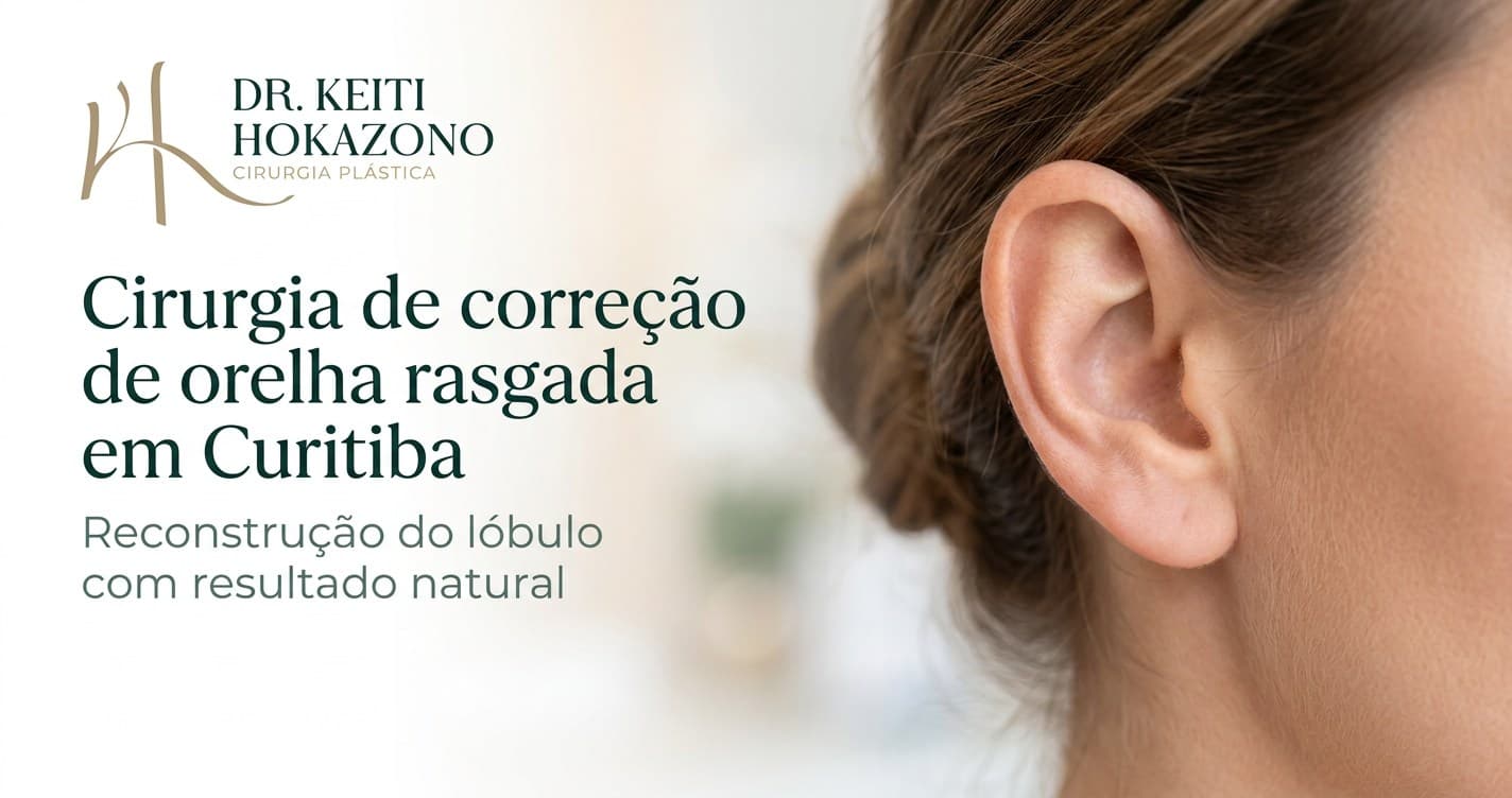 Cirurgia de correção de orelha rasgada em Curitiba: imagem de capa para procedimento informativo do Dr. Keiti Hokazono em Curitiba.